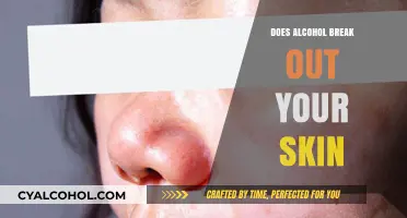 Alcohol and Acne: Unveiling the Truth Behind Skin Breakouts