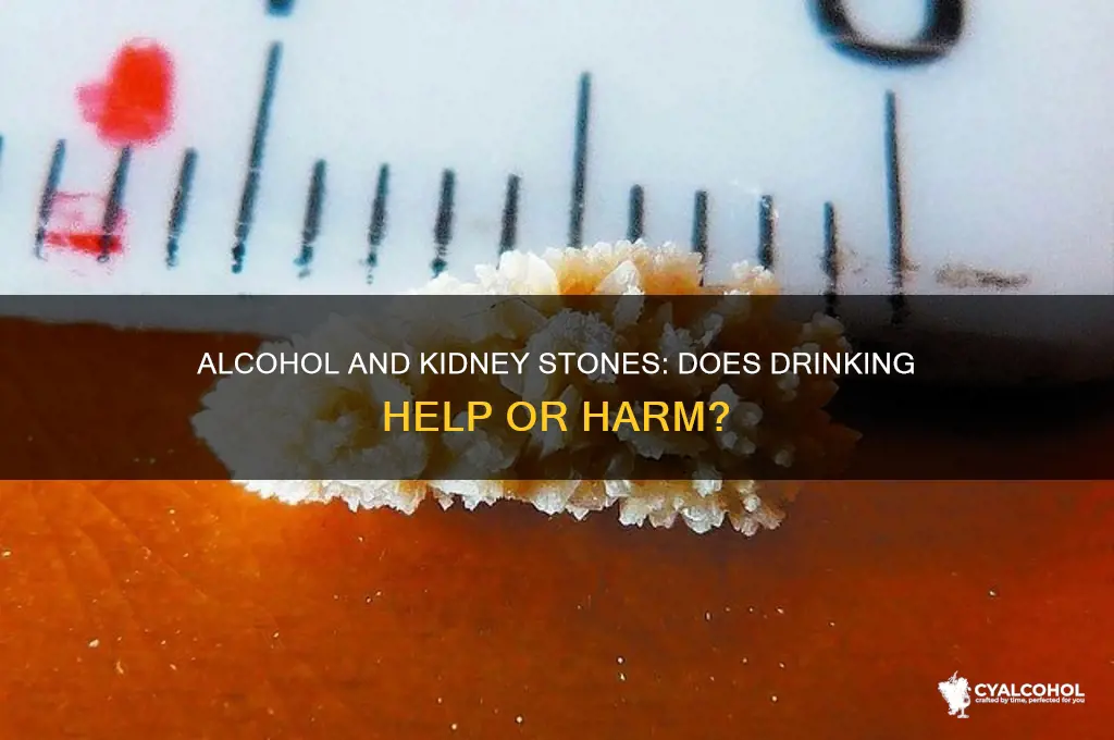 does alcohol break up kidney stones