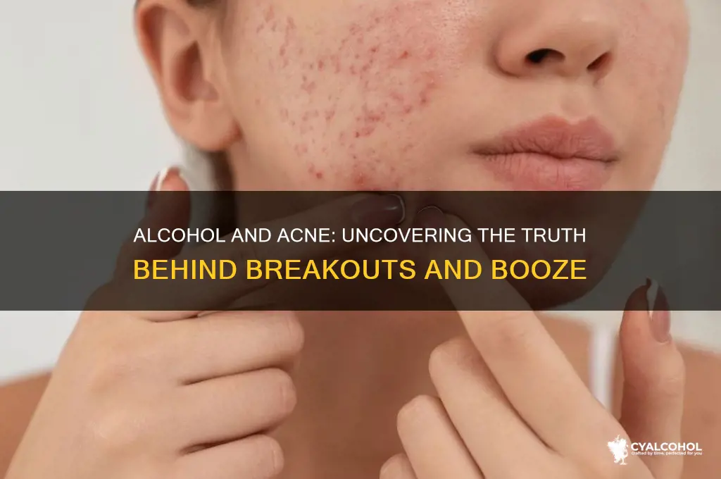 does alcohol break you out