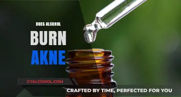 Alcohol and Acne: Does It Help or Worsen Breakouts?