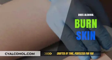 Does Alcohol Burn Skin? Understanding Effects and Safe Usage Tips