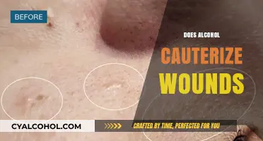 Alcohol and Wound Care: Does It Really Cauterize Injuries?