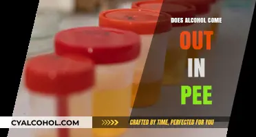 Does Alcohol Show Up in Urine? The Truth Revealed