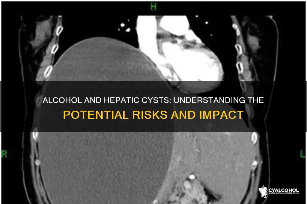 does alcohol consumption aggravate hepatic cysts