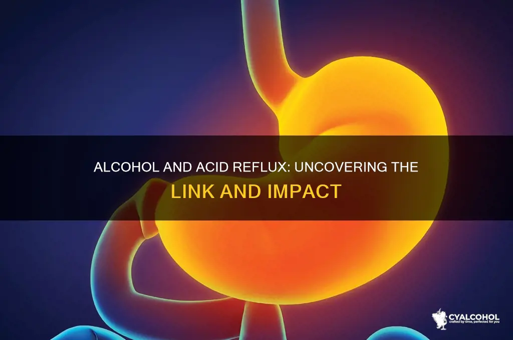 does alcohol contribute to acid reflux