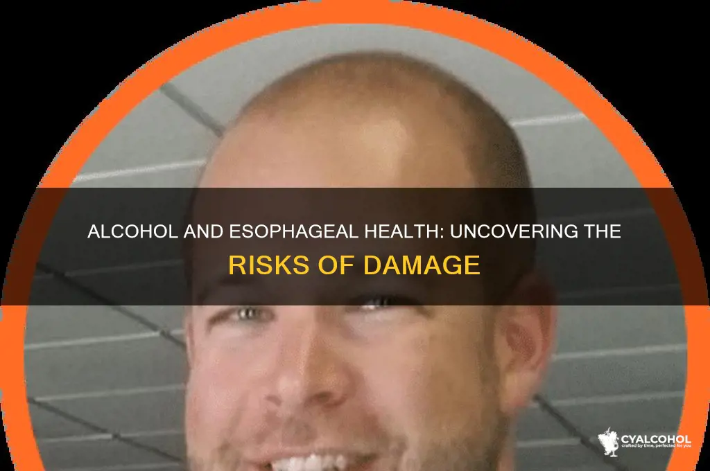 does alcohol damage esophagus