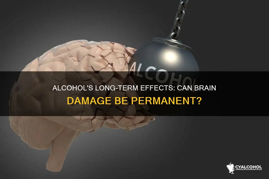 does alcohol damage your brain permanently