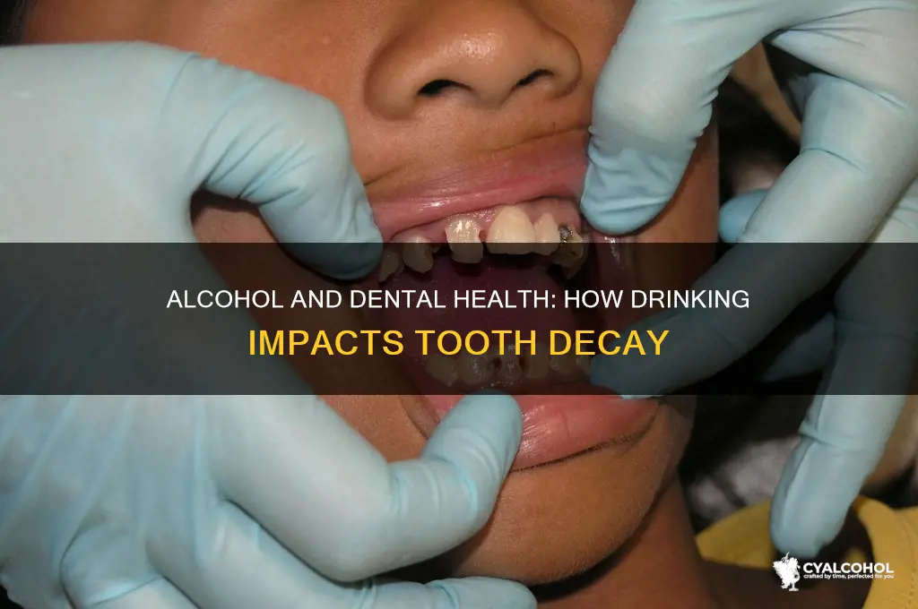does alcohol decay teeth