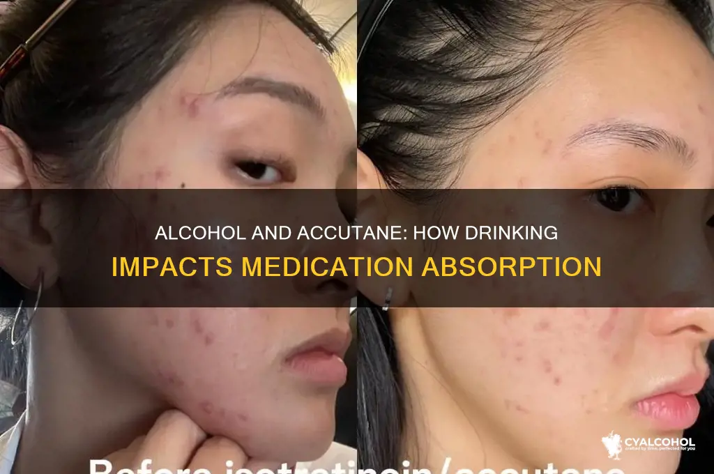 does alcohol decrease absorption of accutane