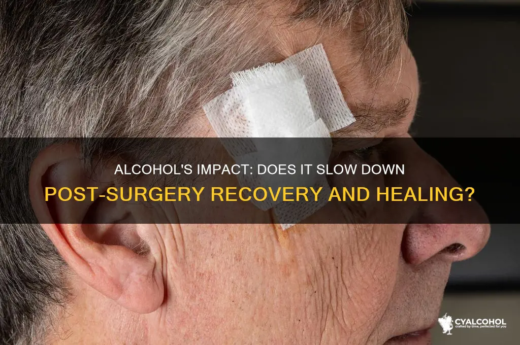 does alcohol delay healing after surgery