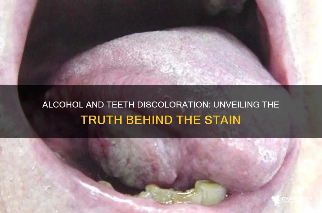 does alcohol discolor teeth