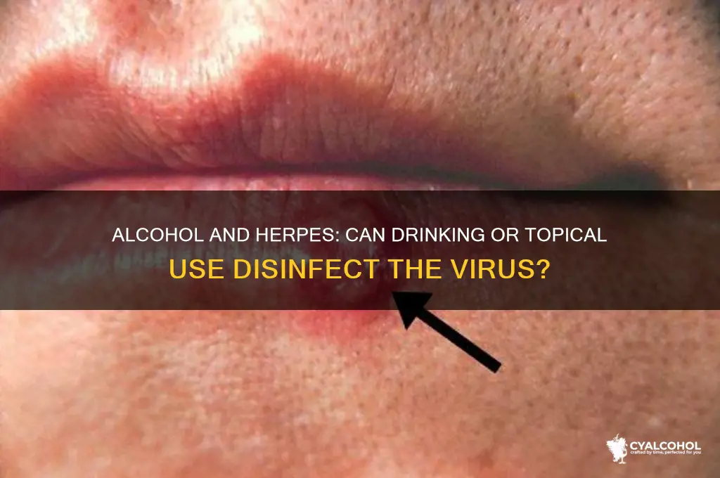 Can Rubbing Alcohol Kill Herpes