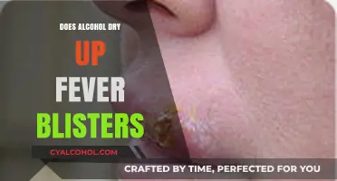 Alcohol and Fever Blisters: Does It Help or Worsen Outbreaks?