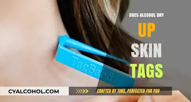 Alcohol and Skin Tags: Does It Cause Them to Dry Up?