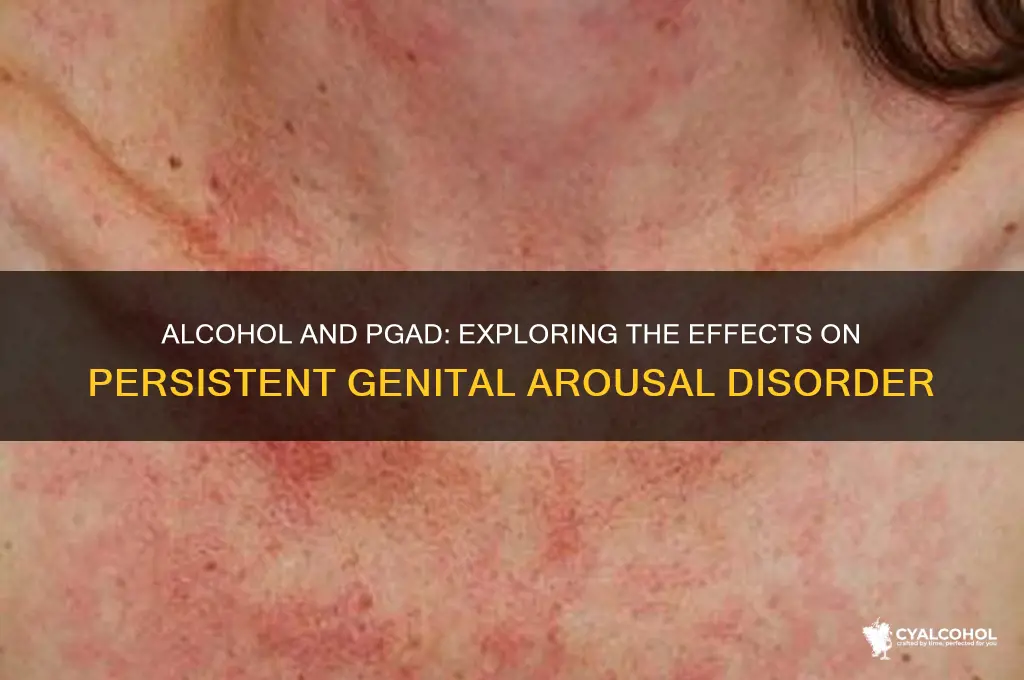 does alcohol enhance pgad