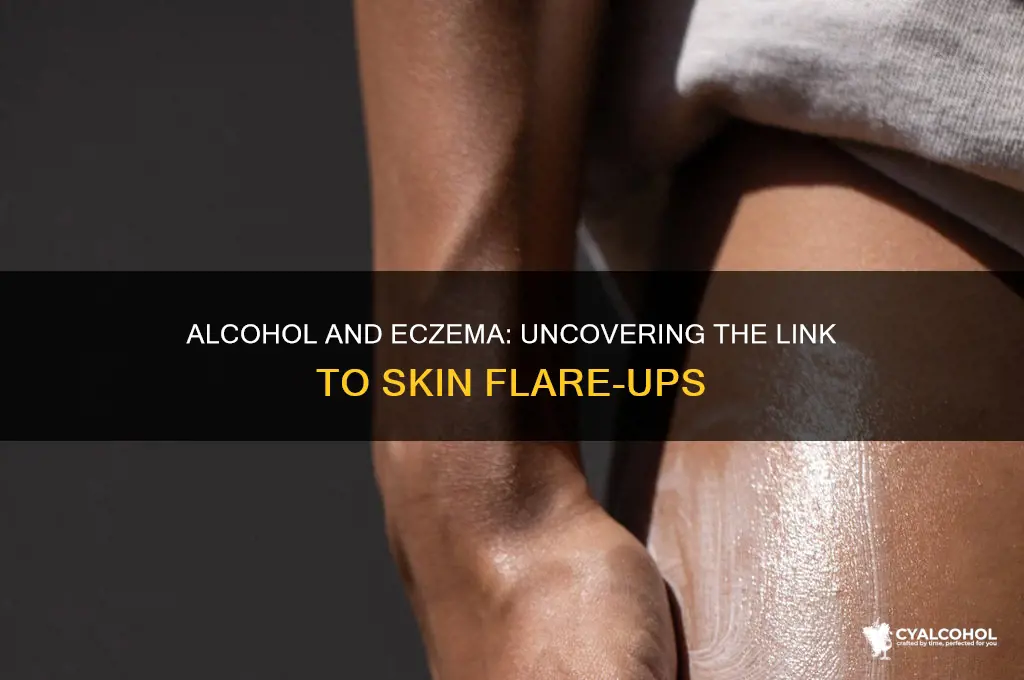 does alcohol exacerbate eczema
