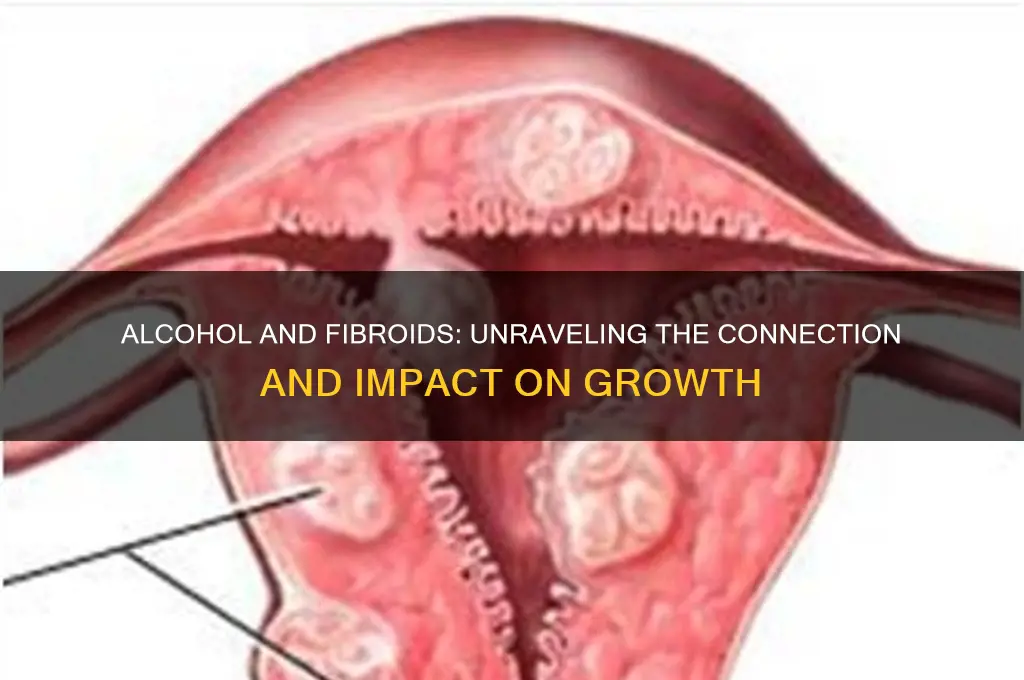 does alcohol feed fibroids
