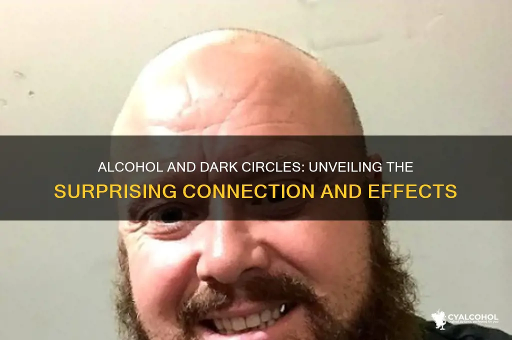 does alcohol give you dark circles
