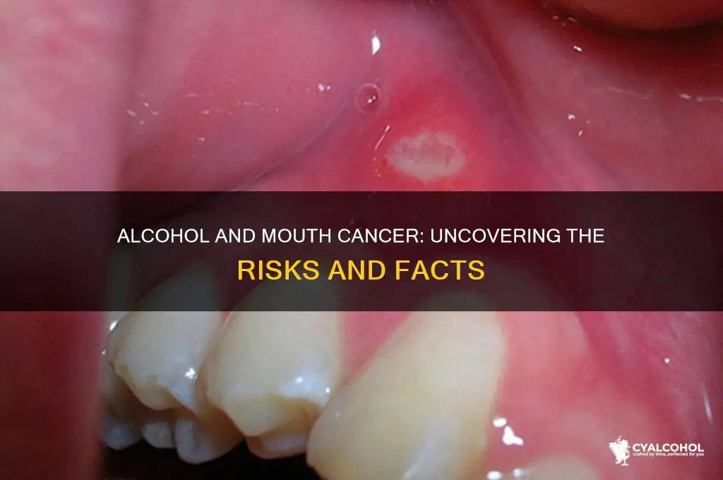 does alcohol give you mouth cancer