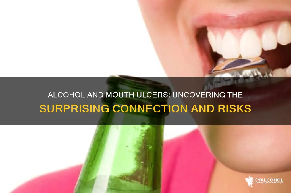 does alcohol give you mouth ulcers