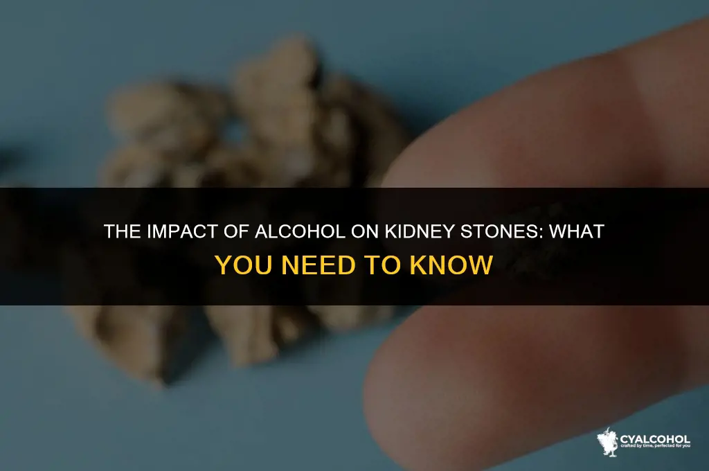 does alcohol hurt kidney stones