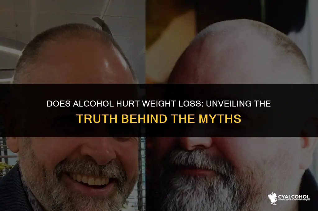 does alcohol hurt weight loss