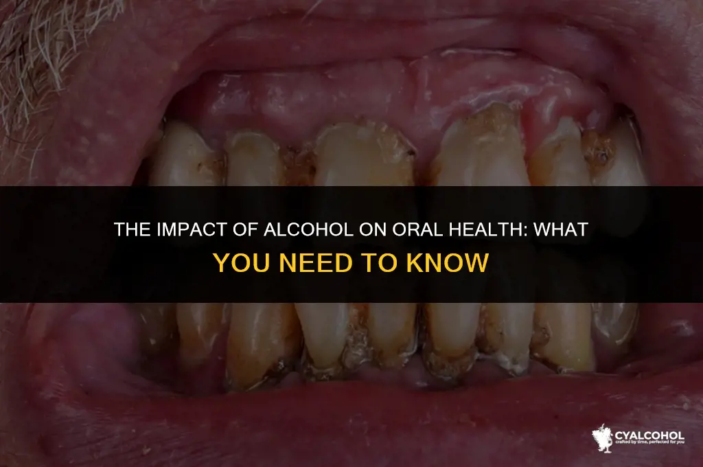 does alcohol hurt your mouth