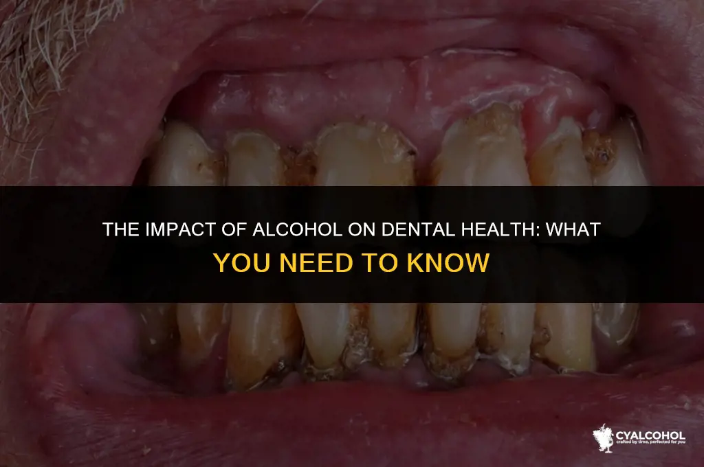 does alcohol hurt your teeth