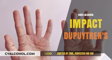 Exploring the Effects of Alcohol on Dupuytren's Contracture: What You Need to Know