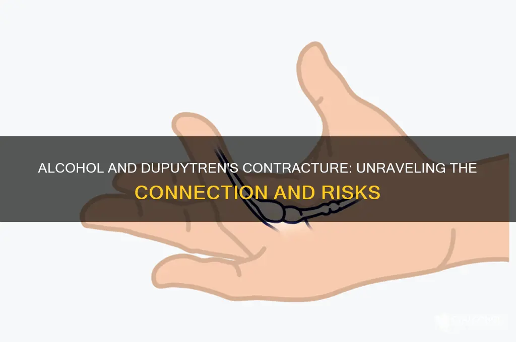 does alcohol increase dupuytren