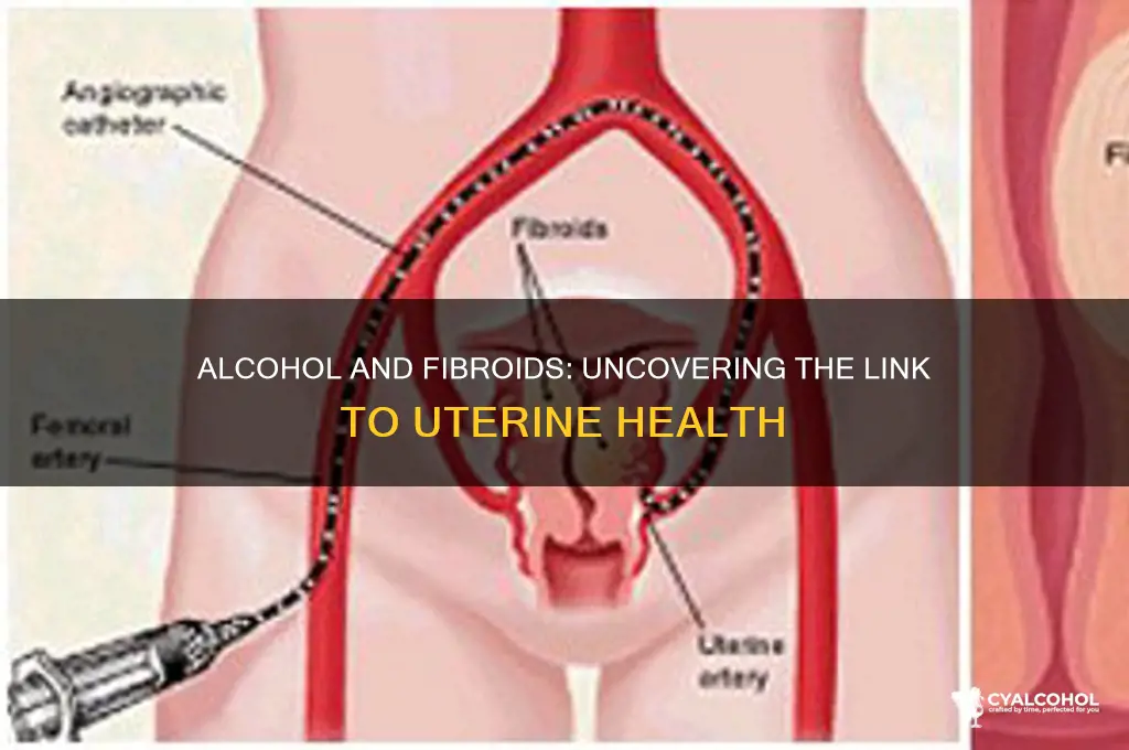 does alcohol increase fibroids
