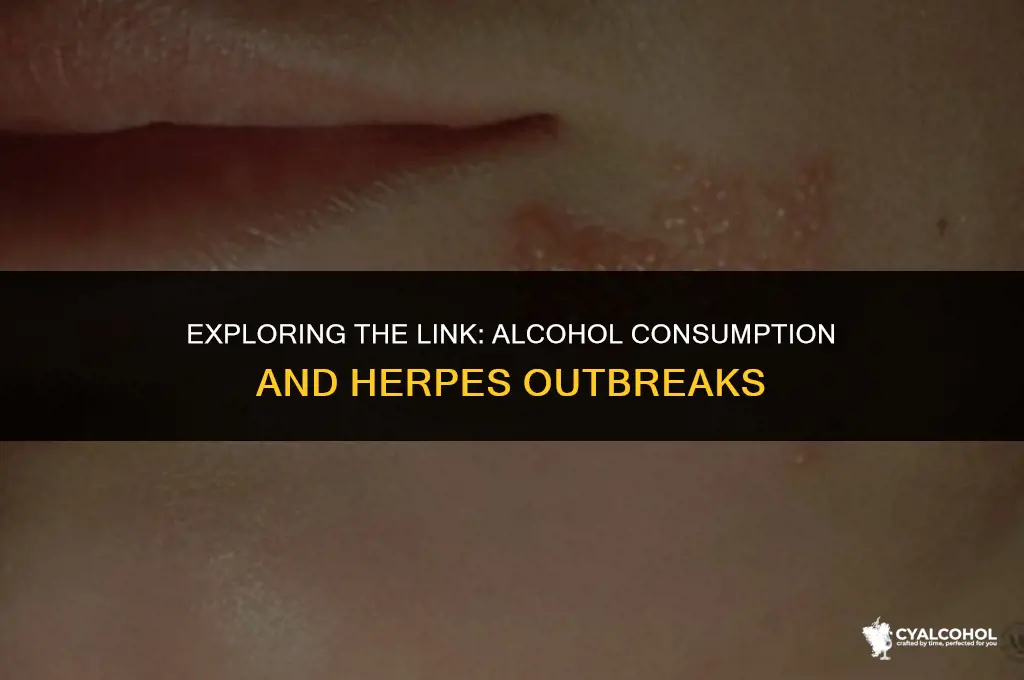 does alcohol increase herpes outbreaks