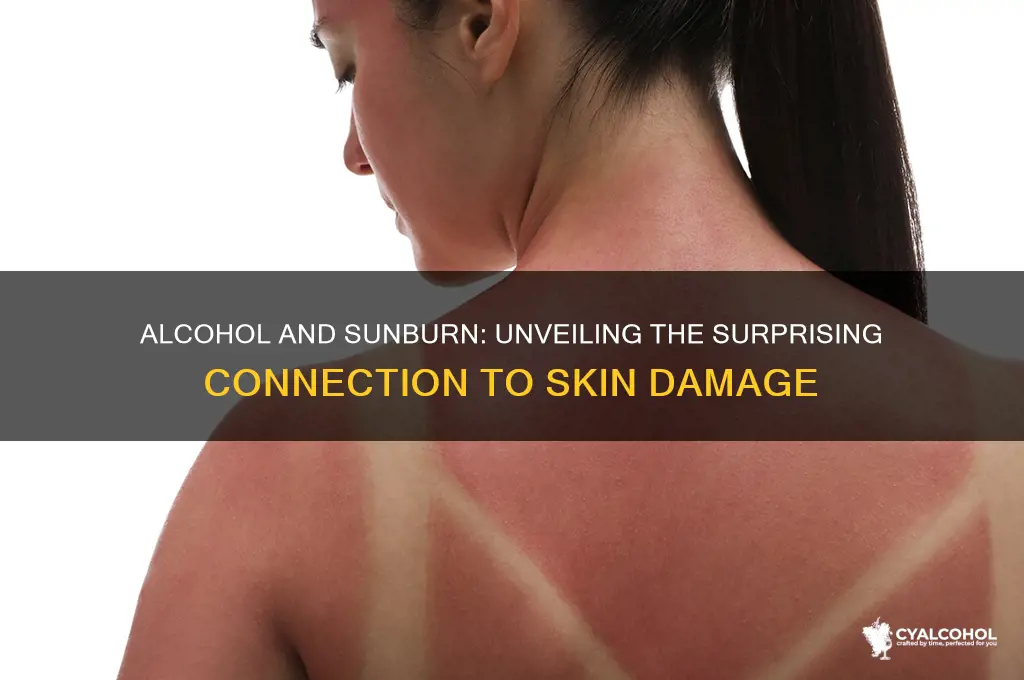does alcohol increase sunburn
