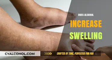 Alcohol and Swelling: Understanding the Link to Inflammation and Edema
