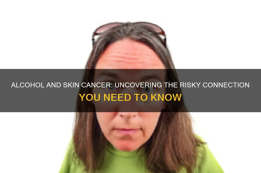 does alcohol increase your chance of skin cancer