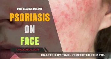 Alcohol and Psoriasis: Does Drinking Inflame Facial Flare-Ups?