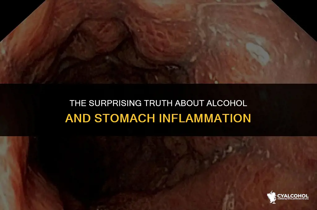 does alcohol inflame your stomach