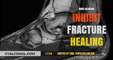 Unveiling the Impact: How Alcohol Affects Fracture Healing