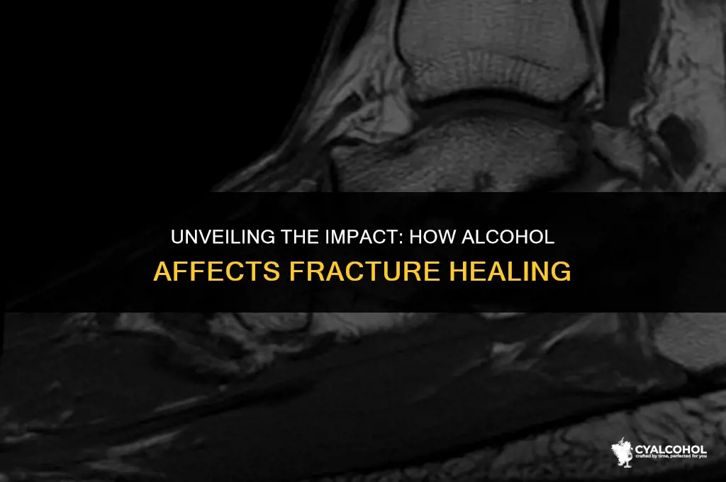 does alcohol inhibit fracture healing
