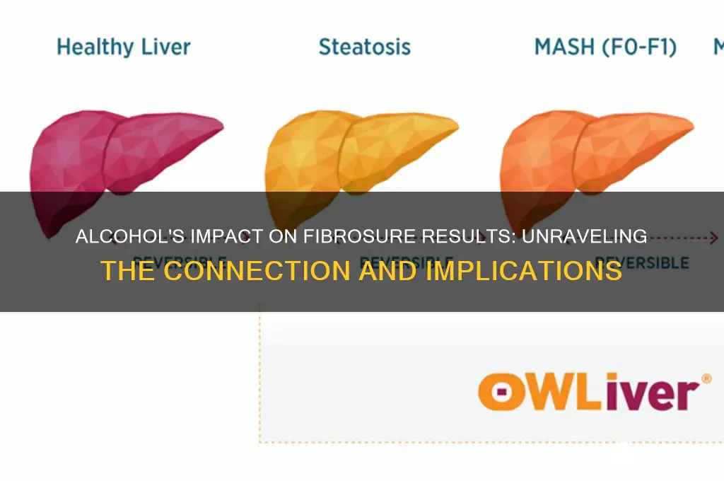 does alcohol intake influence fibrosure results