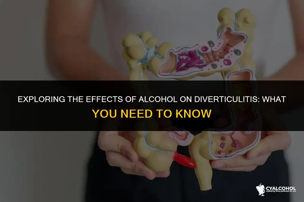 does alcohol interfere with diverticulitis