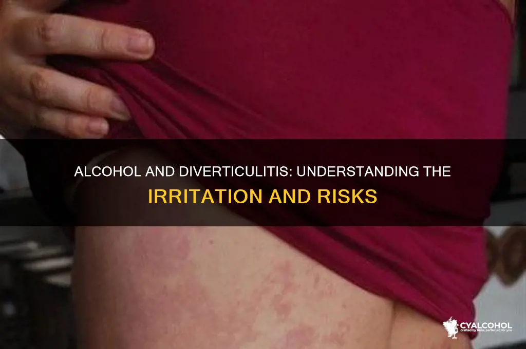 does alcohol irritate diverticulitis