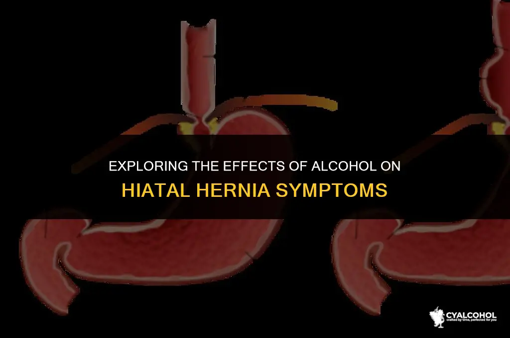 does alcohol irritate hiatal hernia