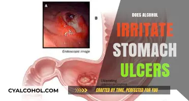 Exploring the Effects of Alcohol on Stomach Ulcers: What You Need to Know