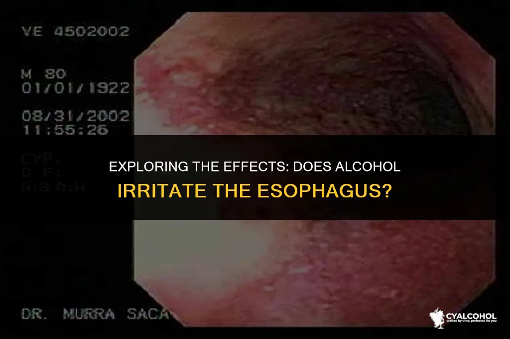 does alcohol irritate the esophagus
