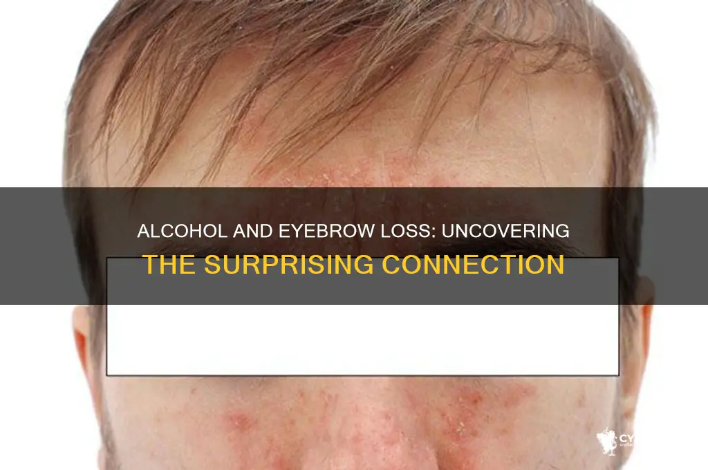 does alcohol lead to eyebrow loss