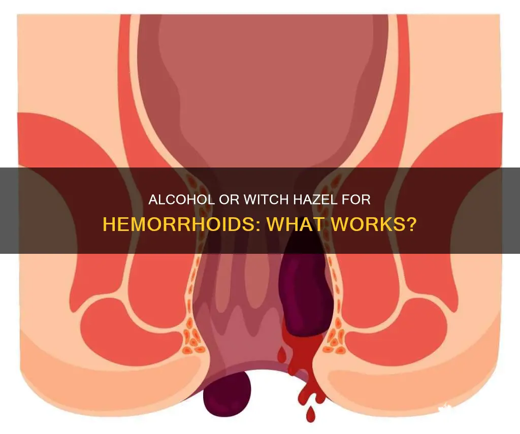does alcohol or witch hazel reduce external inflammation of hemmroids