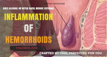 Can Alcohol or Witch Hazel Reduce Hemorrhoid Inflammation?