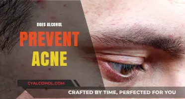Alcohol and Acne: Uncovering the Truth Behind the Myth