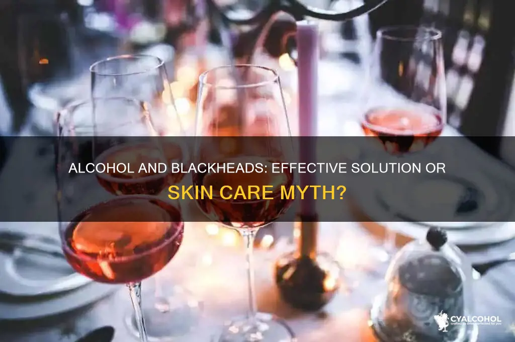 does alcohol remove blackheads